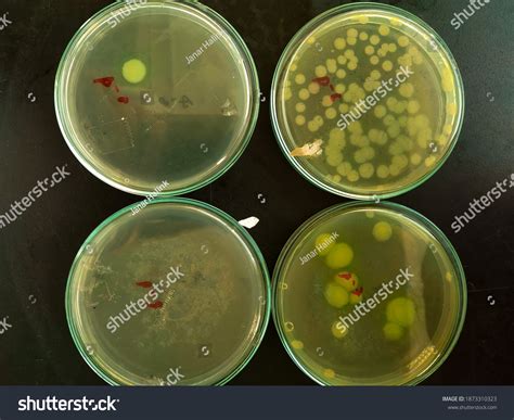 dilution pseudomonas aeruginosa bacteria tsa