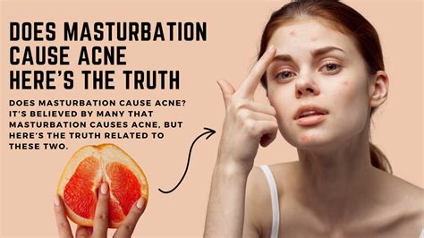 masturbation  acne heres  truth sprint medical