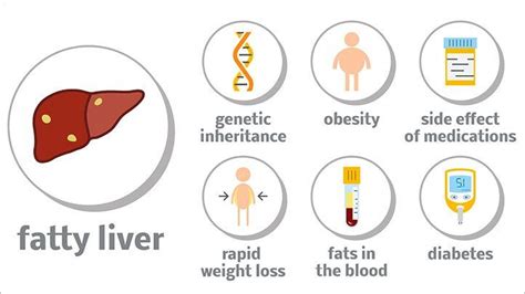 What Is Nonalcoholic Fatty Liver Disease