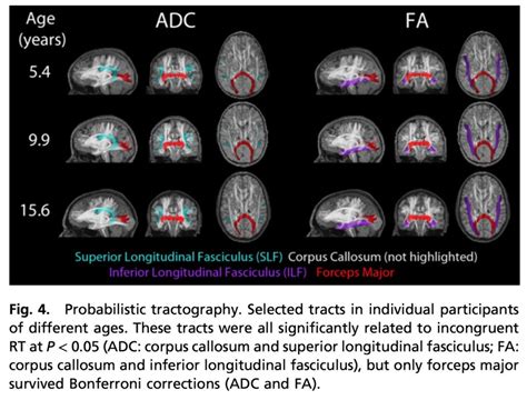 Multimodal Imaging Of The Self Regulating Developing Brain Lcbc