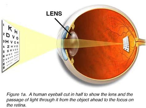 crystalline lens  cataract  joah  aliancy  nick mamalis