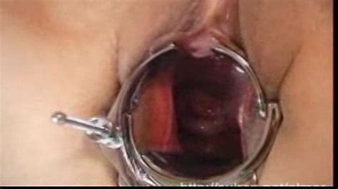 stretching out gaping pussy meat with a speculum porn videos