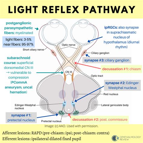 light reflex pathway ophthalmology review