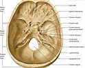Bildergebnis für Foramina parietalia magna. Größe: 124 x 100. Quelle: quizlet.com