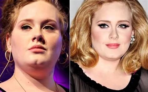 Adele Nose Job Before And After Nice Plastic Ass And