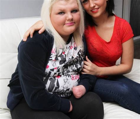 Paige Allan Bullies Make Life ‘hell’ For Girl Who Lost All Her Limbs