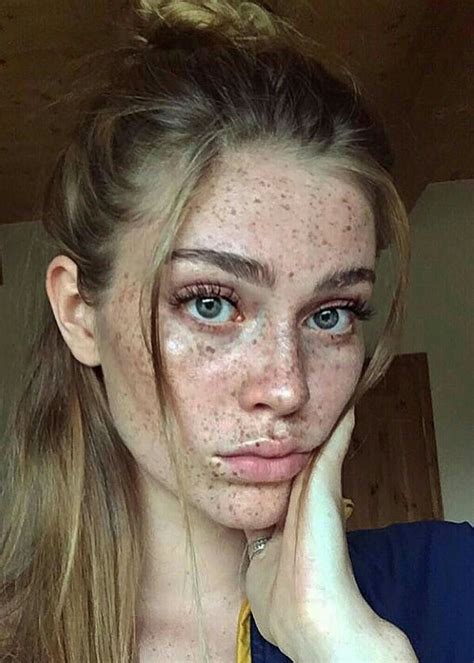 Pin On Freckles Are Beautiful♡