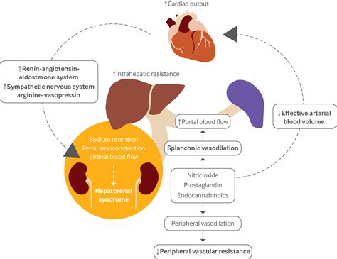 Epidemiology Pathophysiology And Management Of Hepatorenal Syndrome
