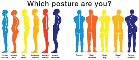 tips   posture radiant life chiropractic