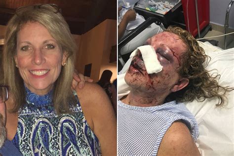 mom recounts savage beating during vacation at dominican republic resort