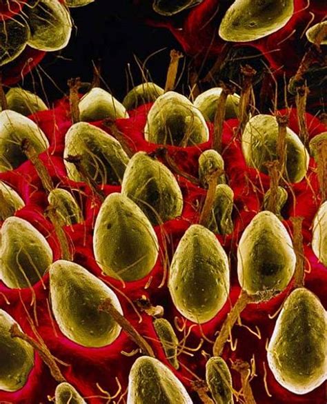 The Amazing And Gruesome World Under A Microscope
