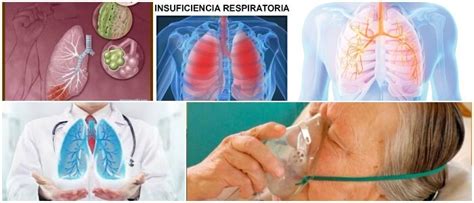 Insuficiencia Respiratoria Clasificación Causas Síntomas