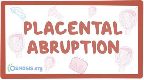Placental Abruption Osmosis