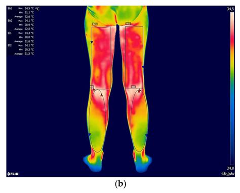 ijerph free full text temperature distribution of selected body