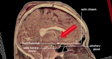 Brain Anatomy Research Raises Questions About Male Female Minds Video