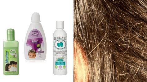 natural hair lice treatment  natural lice treatment products