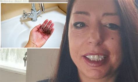 long covid symptoms woman tells  horrifying hair loss  catching
