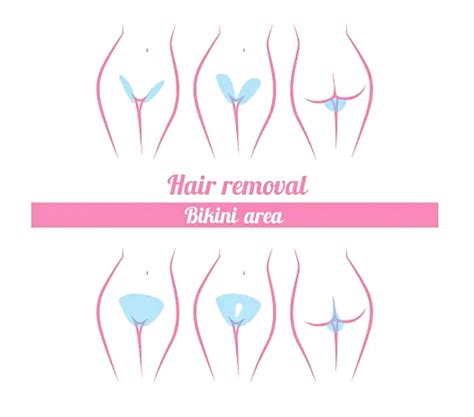 update 79 bikini line laser hair removal in eteachers