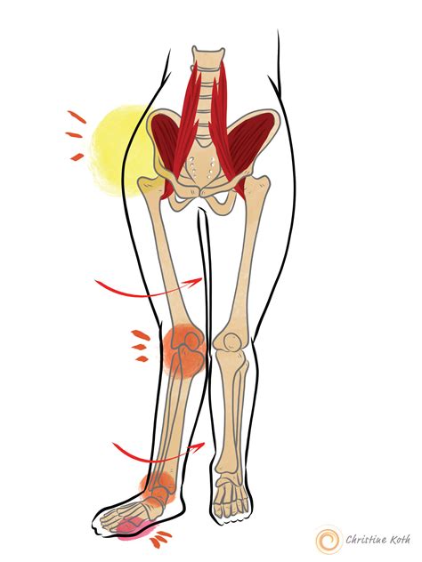 What Muscles Attach Left Hip And Back Are Your Hip Flexors Causing