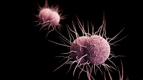 gonorrhea is getting even harder to treat cbs news