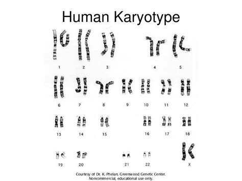 ppt karyotypes and chromosomal disorders powerpoint presentation free