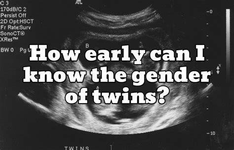 how early can i know the gender of twins dad s guide to twins