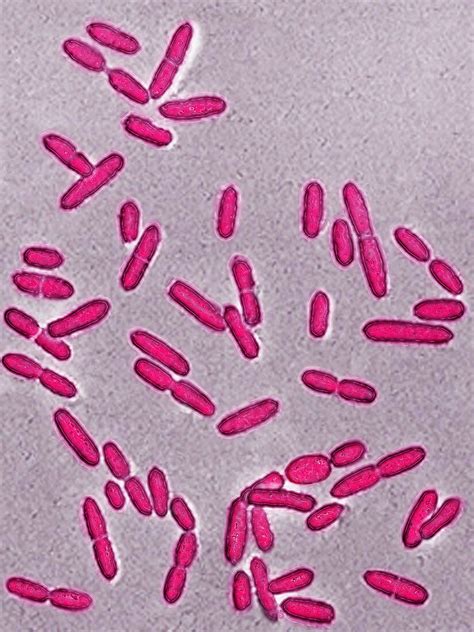 listeria monocytogenes bacterialm bild kaufen  science