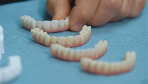 common questions  zirconia teeth  teeth