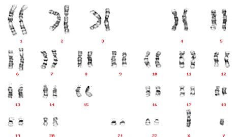 A Karyotype Of A Normal Male 46 Xy Reproduced Courtesy Of Human
