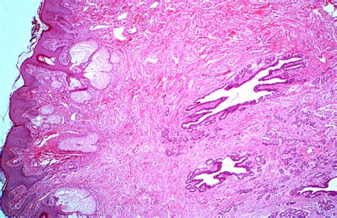 hls [ female reproductive system nipple female lactiferous ducts