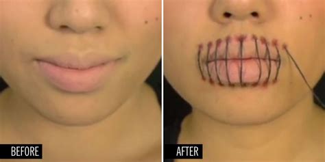 This Super Creepy Stitched Mouth Makeup Tutorial Is Perfect For Halloween