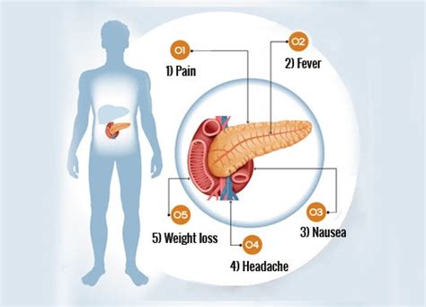 6 Symptoms Of Pancreas Problems Step To Health