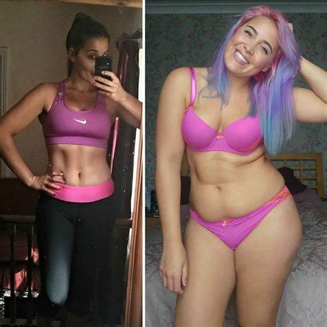 This Anorexia Survivor Bravely Shut Down Body Shamers On Instagram Allure
