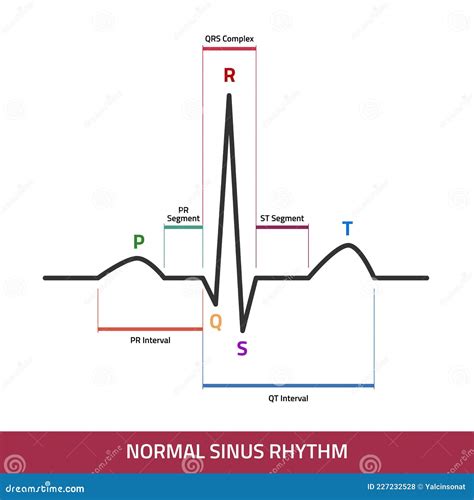 ecg normal sinus rhythm infographic diagram stock illustration images