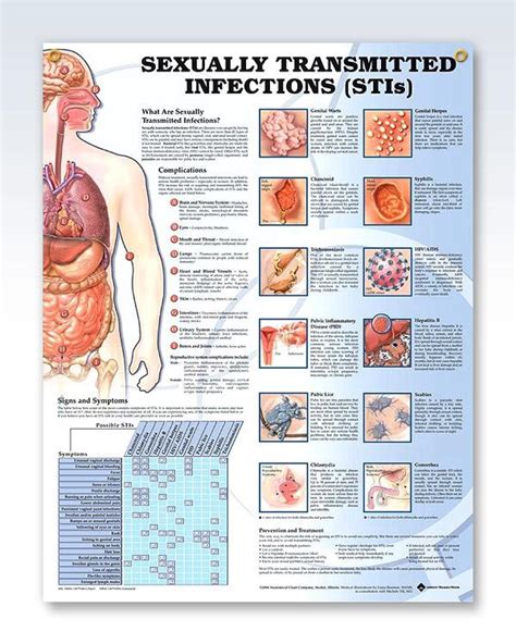 Sexually Transmitted Infections Exam Room Anatomy Poster
