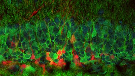 What Do Neurons Look Like When They Re Growing In The Brain Mental Floss
