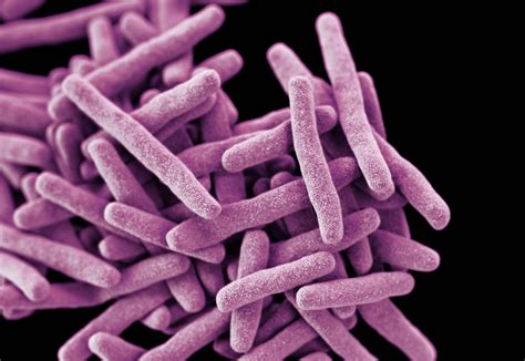 tb superbugs  special attention    continue  turn