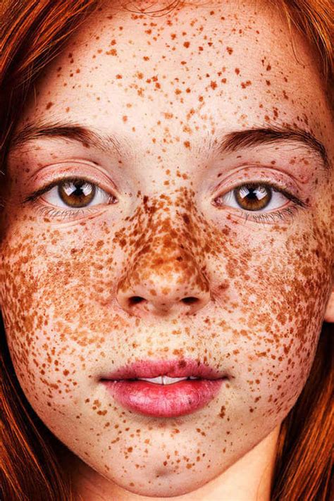 amazing portraits  prove freckles  beautiful