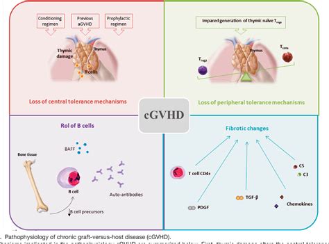 understanding graft  host disease preliminary findings