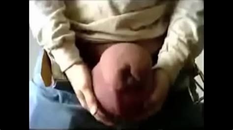 Enormes Genitales Masculinos Implantados Con Silicona Xvideos Com