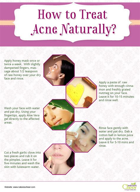 how to treat acne naturally visual ly