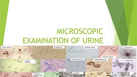 microscopic examination  urine youtube