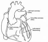 Coronary Arteries Angiogram Diagonal Angioplasty Stent Circulation Pci Veins Artery Darah Aliran Medication Specialists Pediatric Insertion Discharge Advice Clipartxtras Descending sketch template