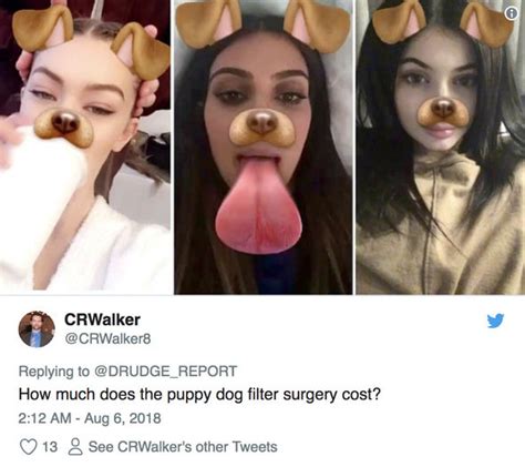 Snapchat Dysmorphia Warning Doctors Reveal Surgery Craze To Look