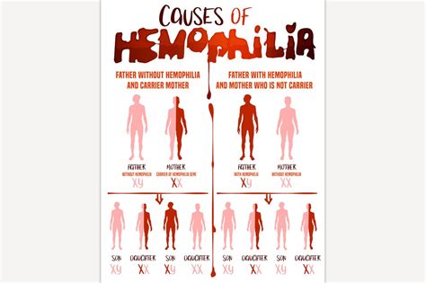 hemophilia causes poster pre designed photoshop graphics ~ creative