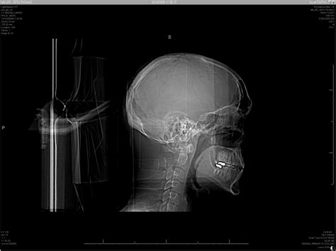 it s elemental x ray of my head side view