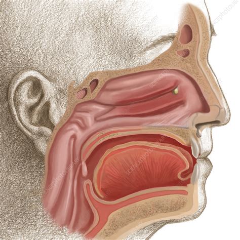 sinus infection stock image  science photo library