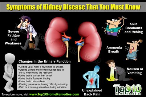 top  symptoms  kidney disease      top  home remedies