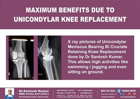 pin  knee treatment