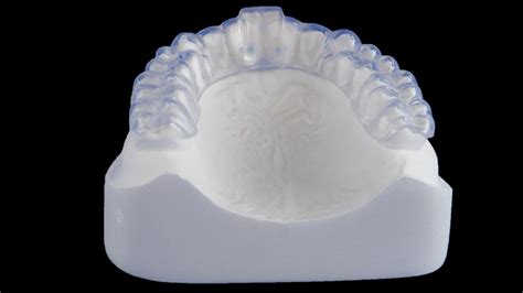 occlusal splints ultralight dental appliances